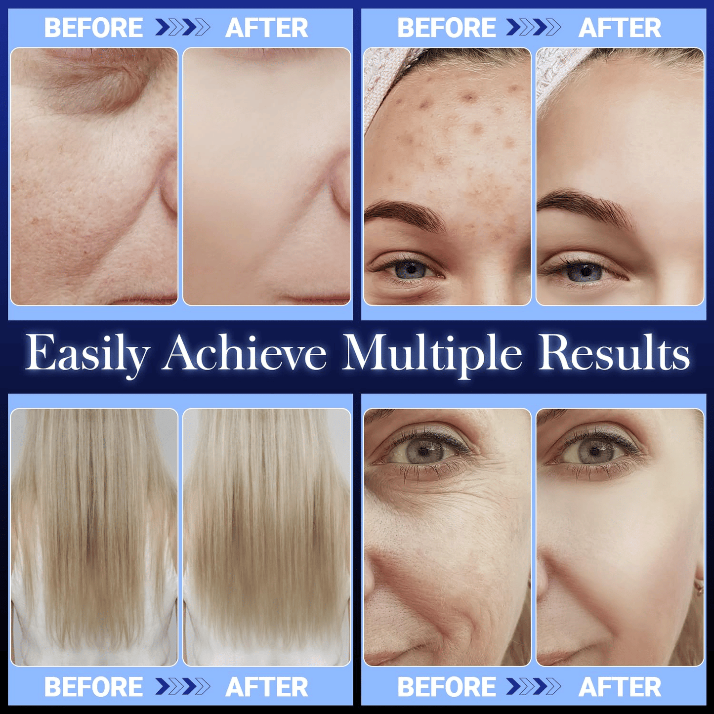4-in-1 High Frequency Facial Wand for Skin Rejuvenation – Portable Anti-Aging Beauty Device for Wrinkle Reduction, Firming, Dark Circle & Acne Care.