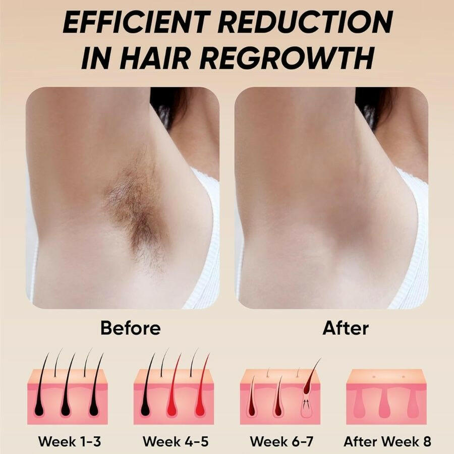 IPL Hair Removal Device – 900,000 Flashes 5 Power Levels Permanent Reduction - GoTypical